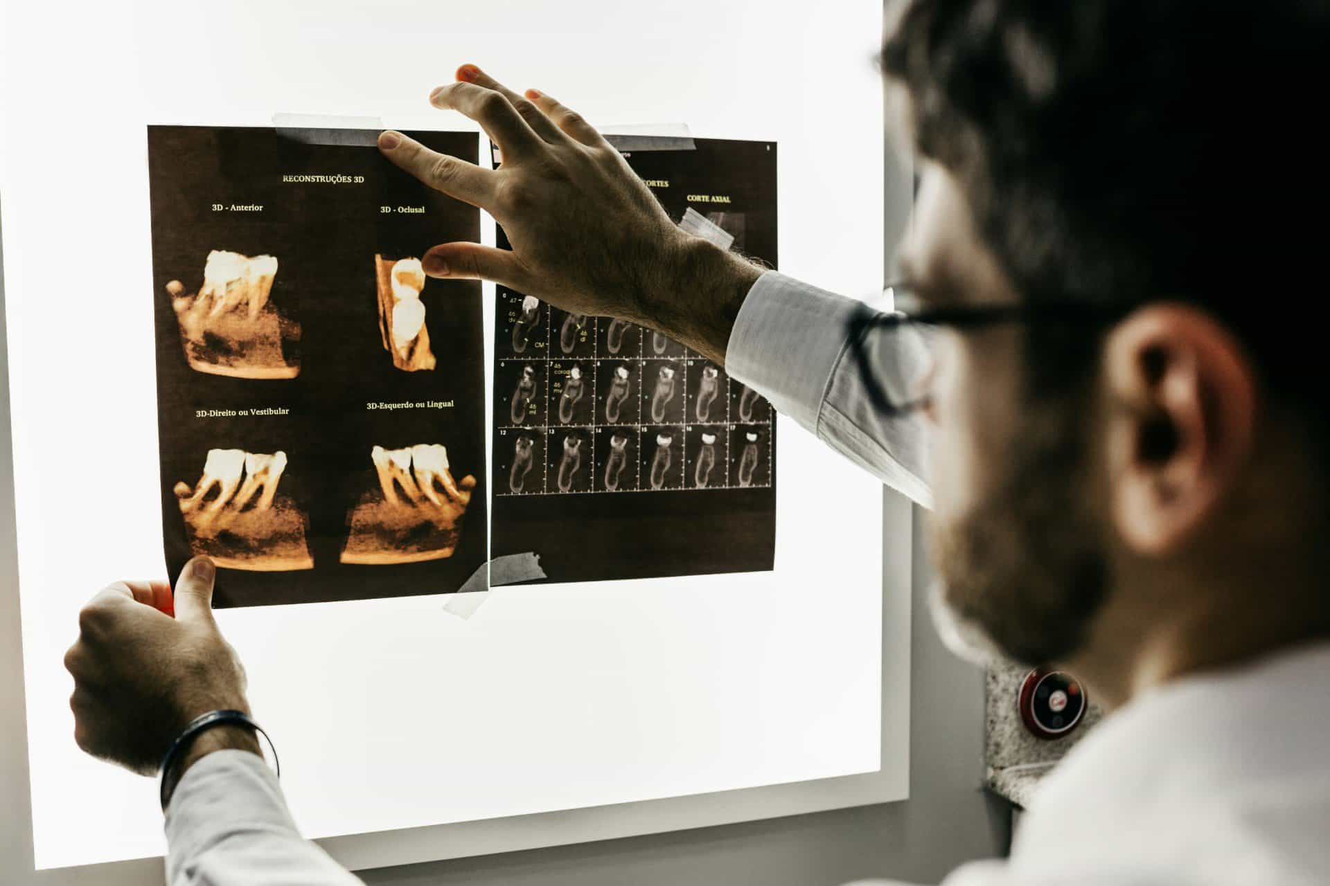 Dental imaging